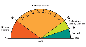 Estimated Glomerular Filtration Rate