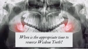 remove wisdom teeth