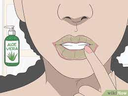 simple ways to heal a lip burn 9 steps