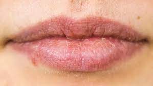 lips care tips perfect home remes