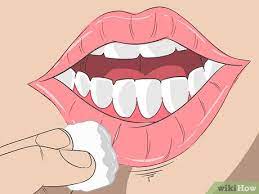 3 ways to cure exfoliative cheilitis