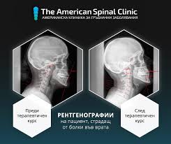 Този клип е насочен към хора с болки във врата. Rentgenografii Na Pacient Stradash Ot The American Spinal Clinic Facebook