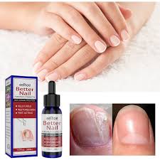 press on nails nail repair fingernail