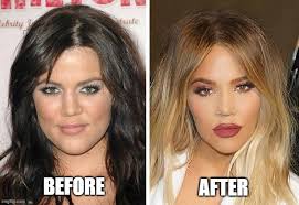 kardashian makeover where did the chin