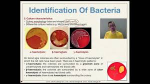 Biochemical Tests For Identification Of Bacterial Pathogens