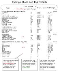 Basic Metabolic Panel Slubne Suknie Info