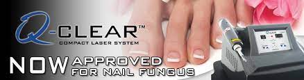 toenail fungus laser therapy miami