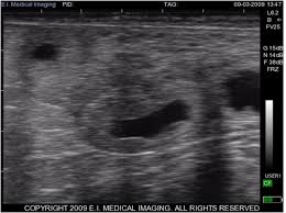 Ibex Ultrasound Stages Of Early Bovine Pregnancy