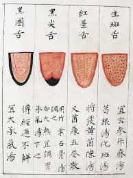 Chinese Tongue Diagnosis Chart 1341