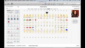 How To Guide To Viive Dental Software For Macs From Henry Schein