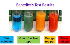 Benedicts Test Objective Principle Reagents Procedure