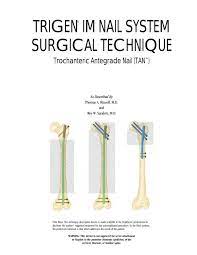 trigenÂ im nail system surgical technique