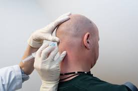 Clusterhoofdpijn symptomen bestaan uit een heftige scherpe, snijdende of brandende pijn rondom het oog of aan de zijkant van het hoofd. Behandeling Van Clusterhoofdpijn Hersenstichting