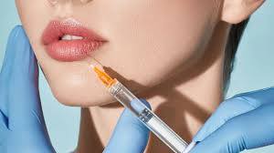 non surgical lip augmentation with