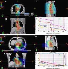 proton beam therapy and concur