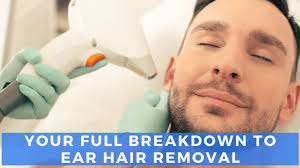 laser ear hair removal everything you
