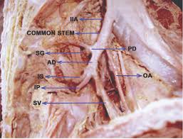 Check spelling or type a new query. Jcdr External Iliac Artery Internal Iliac Artery Inferior Epigastric Artery Pelvic Blood Supply Variations