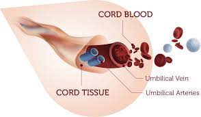 what are newborn stem cells securicord