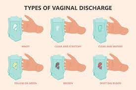 discharge during pregnancy when can it