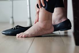 understanding diabetes swollen feet and