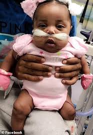 Texas Court Blocks Hospital From Taking Baby Girl Off Life