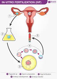 in vitro fertilisation diagram and