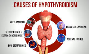 understanding hypothyroidism the