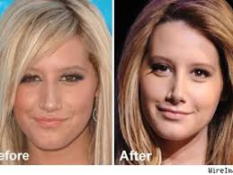 ashley tisdale cuts off nose face not