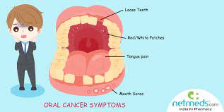 floor of the mouth cancer causes
