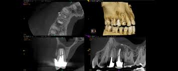 cbct cone beam scanner advance dental