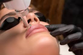 lip laser treatment for dark lips