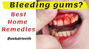 how to cure gum disease at home