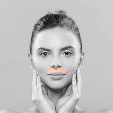 upper lip laser hair removal for women