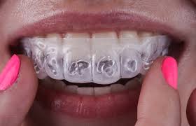 clareador dental caseiro white cl fgm