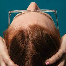 menopause affects your hair and scalp