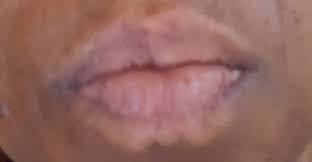 white line around the lips rebecca wood