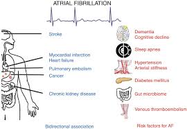 prevention of atrial fibrillation