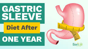 1 year after gastric sleeve what your