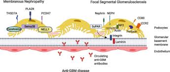 Immune Mediated Kidney Disease