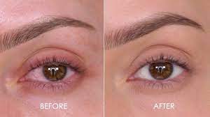 wow how to remove eye redness in