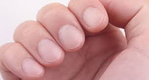 nail abnormalities symptoms causes
