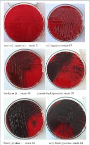 Congo red agar plate test. Examples Of Strains With And Without Ability To Biofilm Formation On Download Scientific Diagram