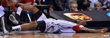 Nba star paul george suffered one of the league's most horrific injuries ever while playing for injuries are considered a normal part of professional sports, but at friday's team usa basketball. Paul George S Injury Weiss Orthopaedics Orthopedic Surgeons