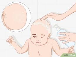 Babies born around their due date or later tend to be larger than those born earlier. 3 Ways To Stimulate Hair Growth In Children Wikihow Mom