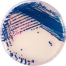 Гидролизат казеина, ферментный гидролизат из животных тканей. Chromagar Strepb Columbia Cna Agar 5 Schafblut