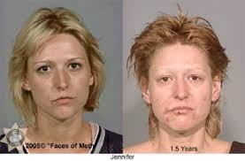 Go Back to the Before and After Crystal Meth Photos Mainpage - meth%2520addict2