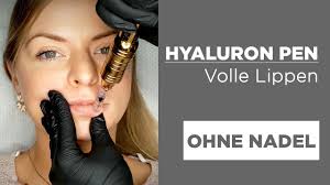 Deze hyaluron pen is inclusief 2 ml hyaluronzuur (greenfiller). Hyaluron Pen Volle Lippen Und Faltenfrei Ohne Nadel