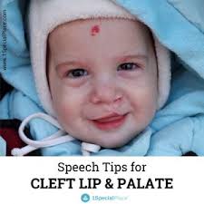 cleft lip and palate sch