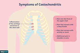 costochondritis causes cureore