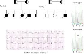 Frontiers Congenital Long Qt Syndrome An Update And